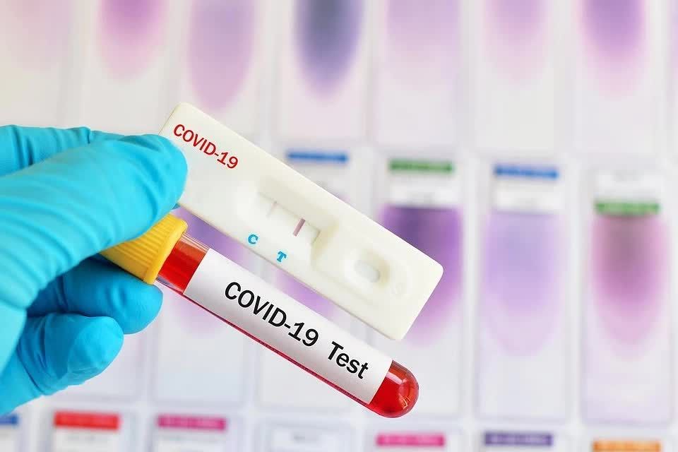 Минздрав: Число людей, тестируемых на COVID, увеличится вдвое.