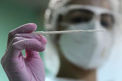 В Молдове подтверждено 665 новых случаев коронавируса.