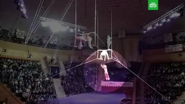 Пострадавшую госпитализировали с травмой головы. 