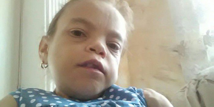Tânăra de 20 de ani din raionul Drochia, care suferea de insuficienţă renală, a decedat. 