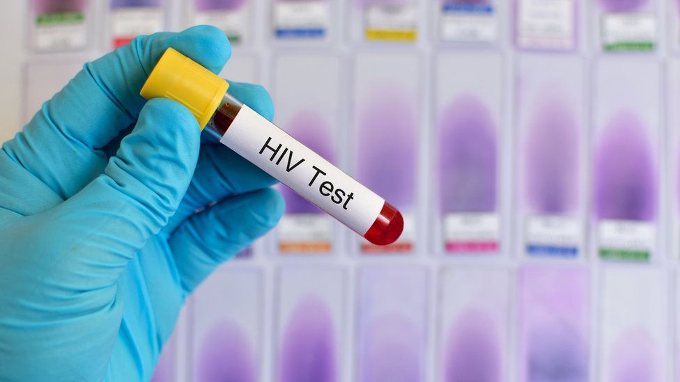 880 de cazuri noi de infecție cu HIV, înregistrate în Moldova în 2024.