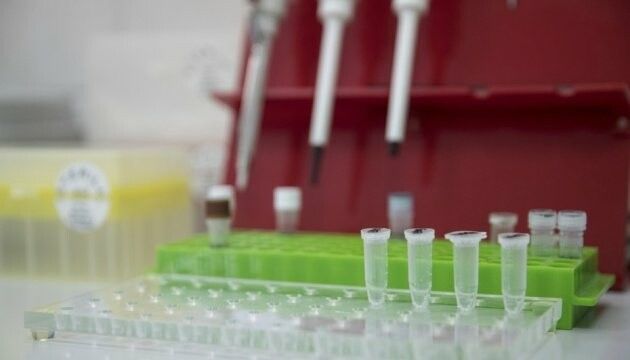Еврокомиссия выделила 100 млн евро для покупки экспресс-тестов на антигены.