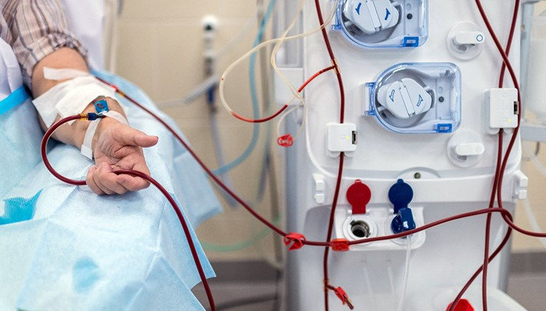 В 2022 году из фондов обязательного медицинского страхования было оплачено более 96 тысяч услуг диализа.