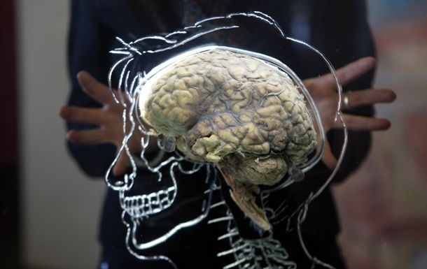 Puterea acestui model de creier constă în faptul că se potriveşte foarte bine cu sănătatea umană.