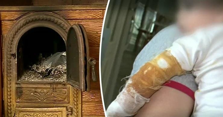 В Приднестровье пятимесячный малыш попал в больницу с ожогами. Коллаж: Point.md