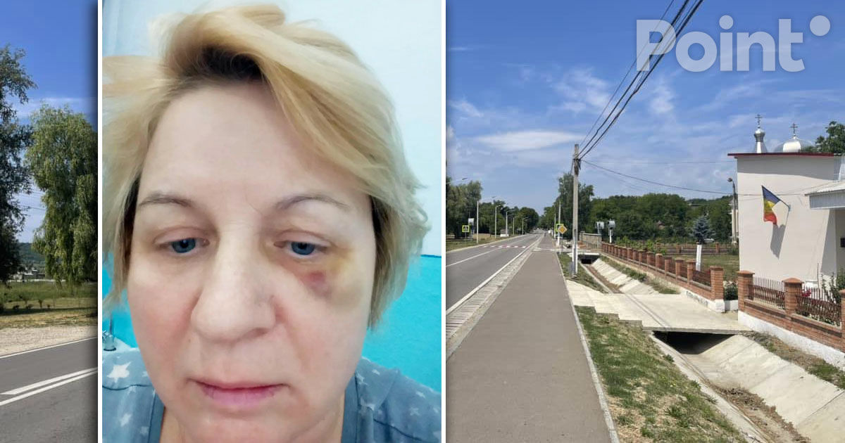 Conflict la Bucovăț: O angajată a Primăriei susține că a fost agresată fizic de șefă.
