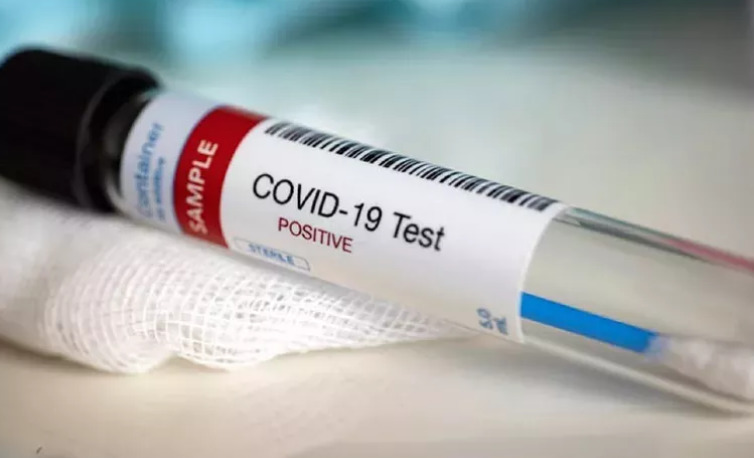 Цены на услуги диагностики COVID-19 будут регулироваться.