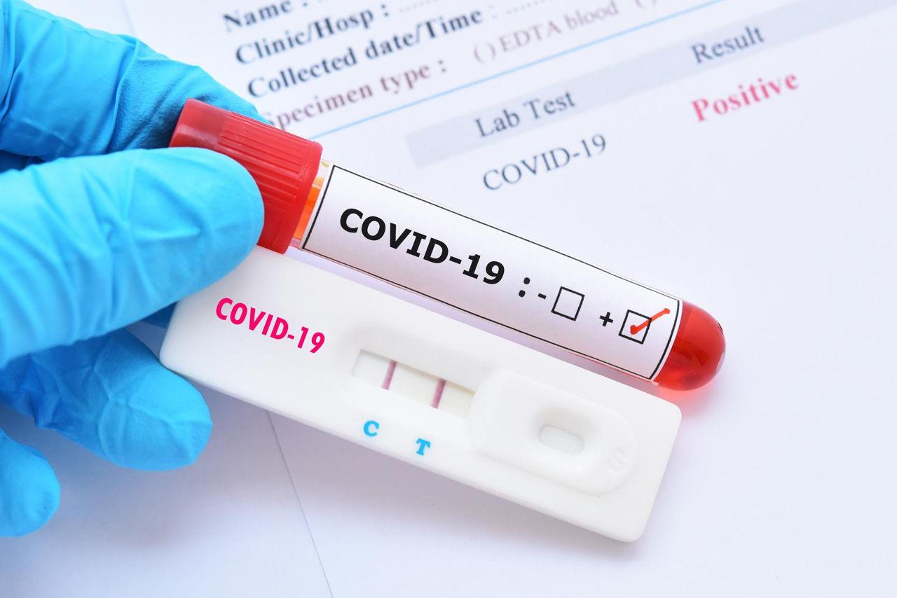 На прошлой неделе в Молдове зарегистрировано 355 случаев COVID-19.