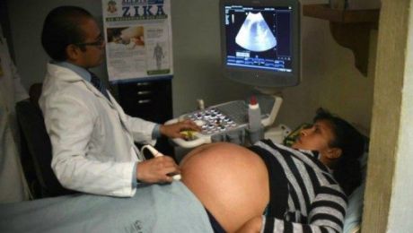 Virusul Zika, depistat în peste 30 de ţări, ar fi responsabil de unele malformaţii cu care se nasc copiii precum microencefalia şi de sindromul Guillain-Barre care cauzează dereglări neurologice.
