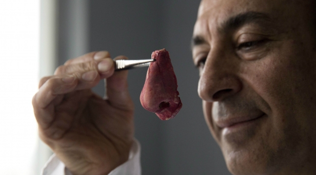 În Londra există un laborator unde cercetătorii fabrică diferite părţi ale corpului uman – urechi, nasuri şi vase de sânge.