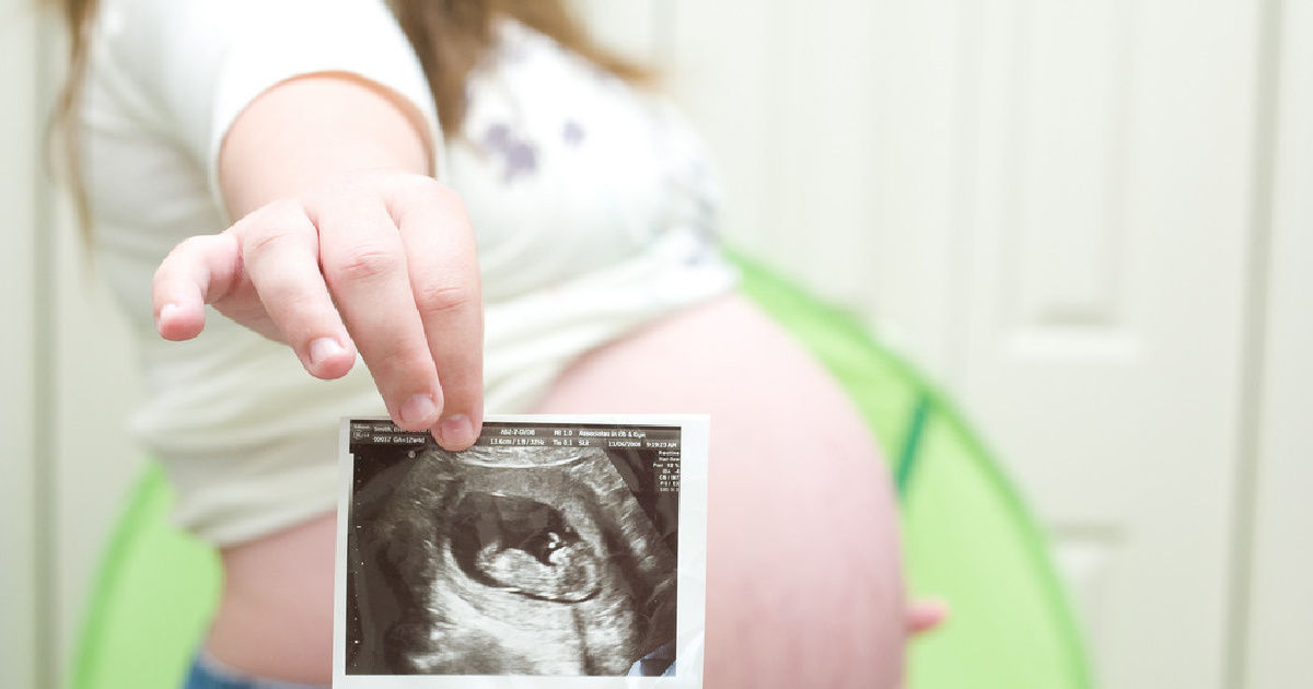 Две американки впервые выносили и родили одного ребёнка.