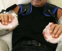 În cazul pacientului american, braţele au provenit de la un donator decedat