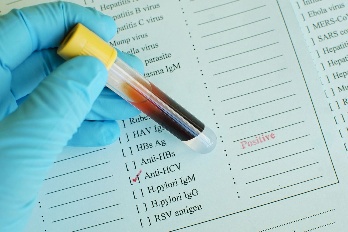 Câte mii de moldoveni s-au tratat de hepatită de la începutul anului. Foto: e-medicina.md