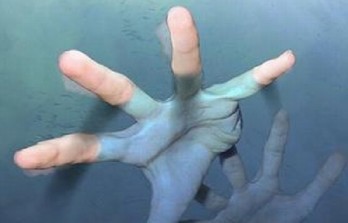 De asemenea, potrivit studiului, rata deceselor din această cauză este de trei ori mai mare în ţările în curs de dezvoltare.