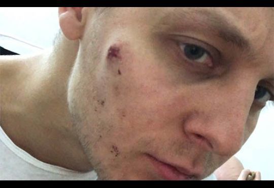 В Киеве избили сына депутата Рады от "Оппозиционного блока".