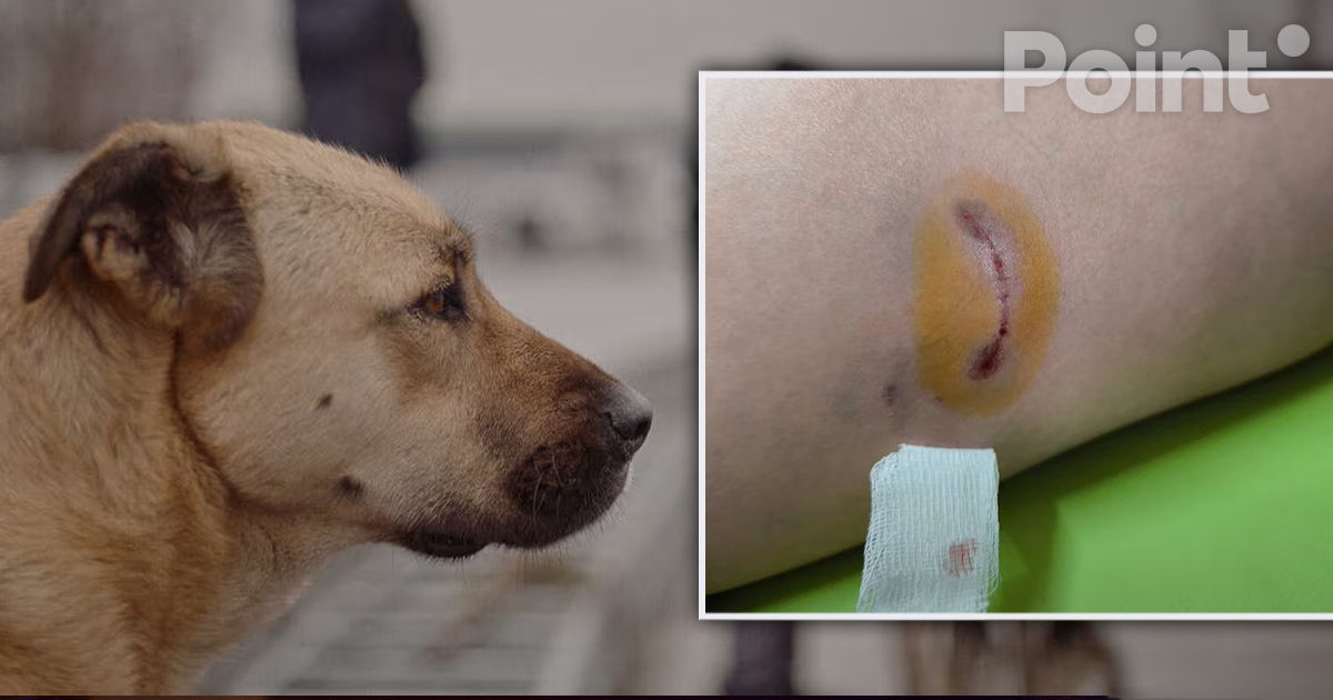 Un copil a fost atacat de un câine maidanez la Bălți.