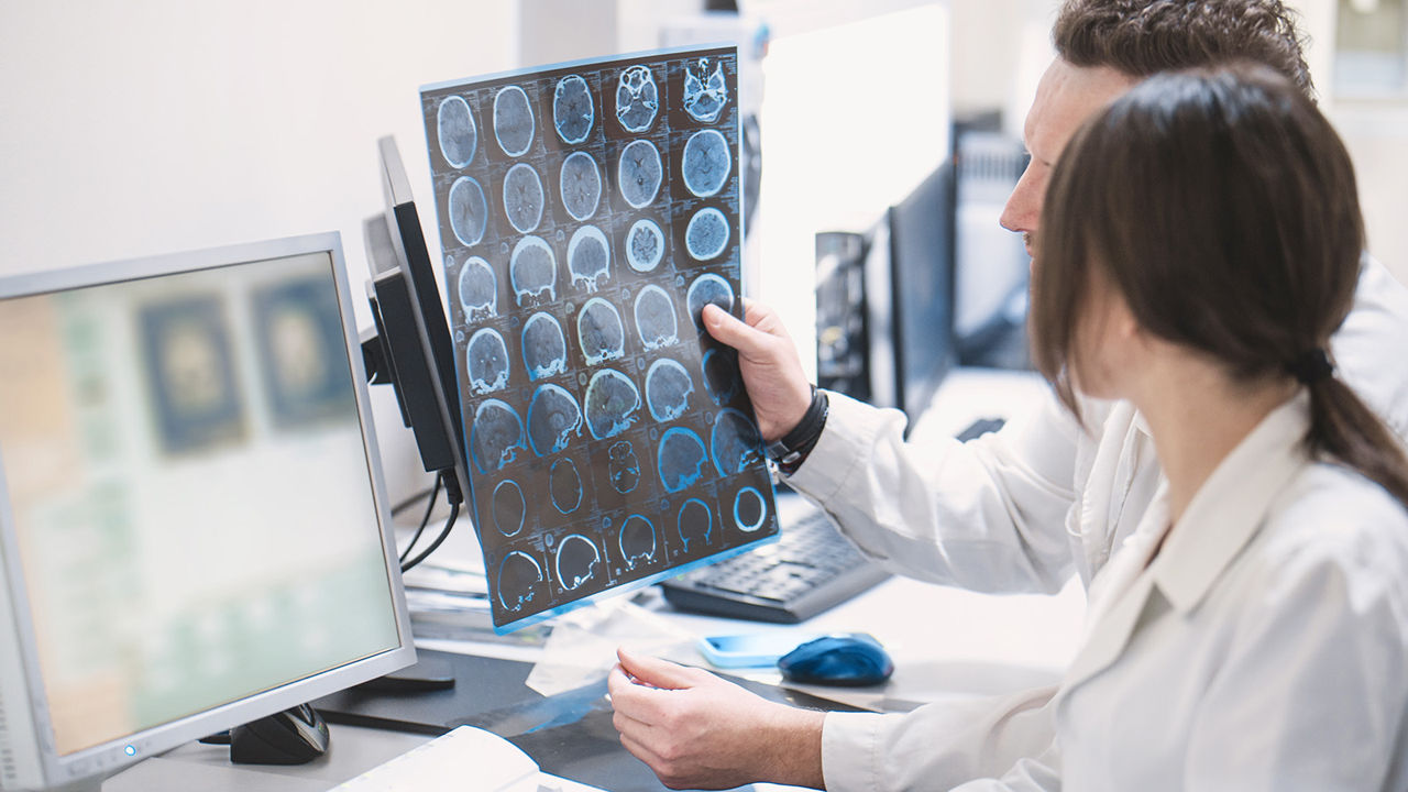 Studiu: Deficitul a șase grupe de vitamine accelerează dezvoltarea bolii Alzheimer.