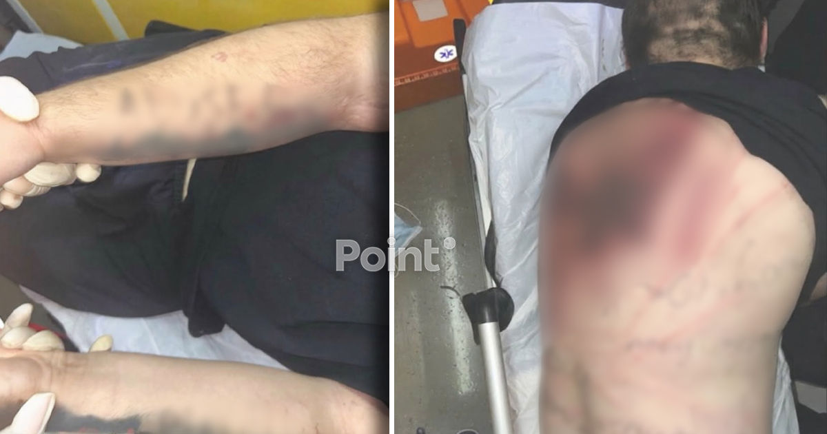 Жестокое нападение на студента в Кишинёве: появились шокирующие фото полученных травм.