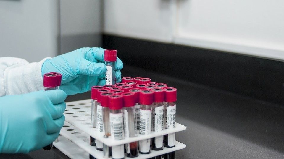 В Румынии за сутки зафиксировали 143 новых случая COVID-19.
