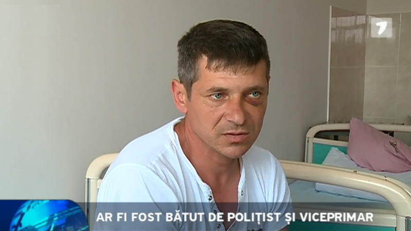 Житель Штефан-Водэ утверждает, что его избили полицейские и заместитель мэра.