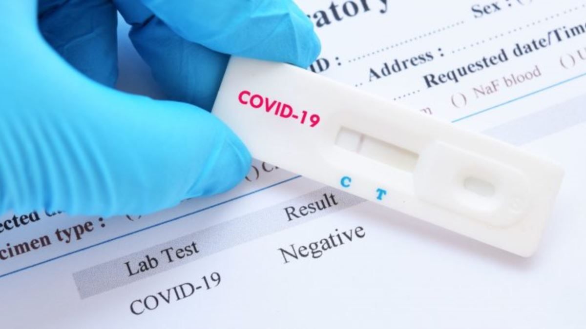 Более 27 тысяч граждан сделали тесты на COVID-19 за свой счет.