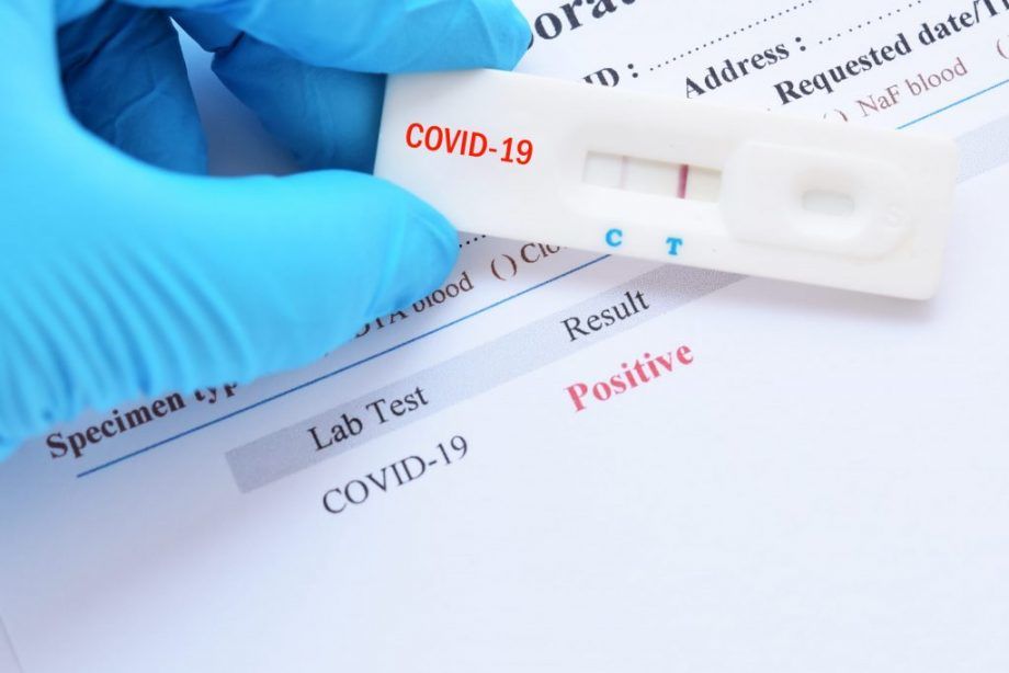В аптеках Румынии будут тестировать граждан на COVID-19.