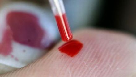Potrivit oamenilor de ştiinţă, analiza de sânge ar putea fi disponibilă publicului larg peste cinci ani.