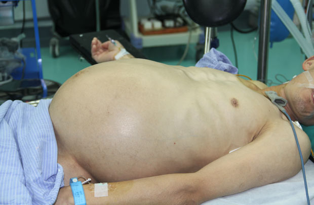 Medicii de la spitalul Changsha, situat într-o provincie din sudul Chinei, au îndepărtat tumoarea.