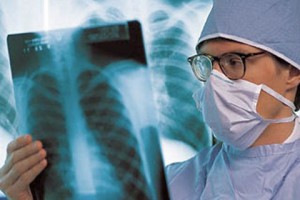 В детском саду в Бельцах у ребёнка обнаружили туберкулёз. Фото: medvesti.com