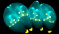 Toxoplasma gondii este un parazit care cauzează boala numită toxoplasmoză