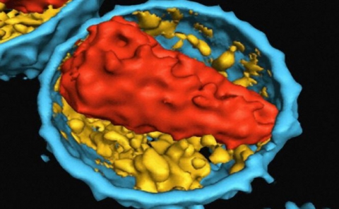 Acesta este cel de-al doilea caz, la nivel mondial, în care o persoană infectată cu HIV se vindecă complet.  