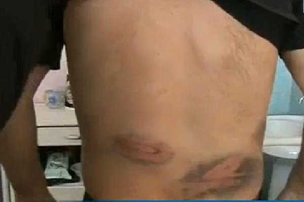 Unul dintre pătimiţi a fost internat în spital cu traumatism cranio-cerebral închis