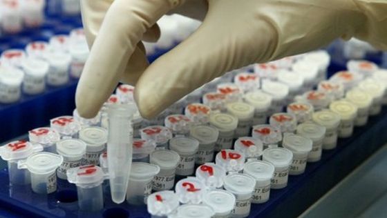 O fiolă care conține un virus ce poate provoca febră hemoragică a dispărut dintr-un laborator din Galveston, Texas.