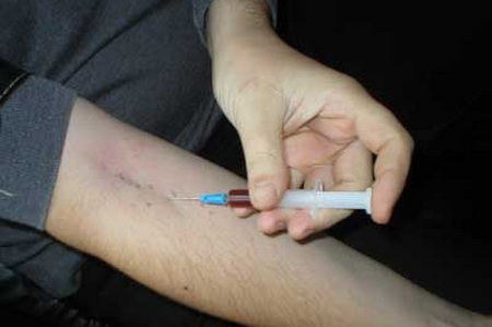 Numărul consumatorilor de droguri în Moldova crește de la an la an