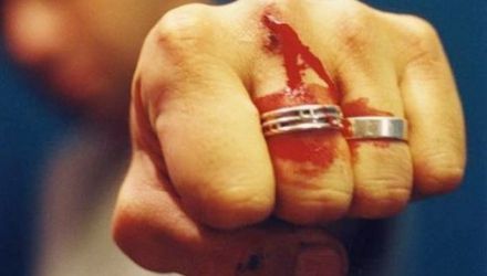 Suspectul nu își recunoaște vina și declară că soția sa a căzut pe scări. 