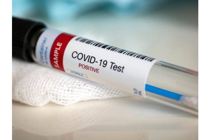 Минздрав сообщил о 382 случаях заражения COVID-19 среди беженцев.