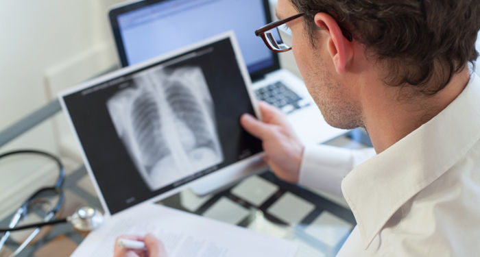 Moldova va obține 15,8 mln euro pentru combaterea tuberculozei și HIV/SIDA.