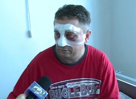Șeful Consiliului superior al procurorilor, Iurie Garaba, implicat săptămâna trecută într-un accident rutier.
