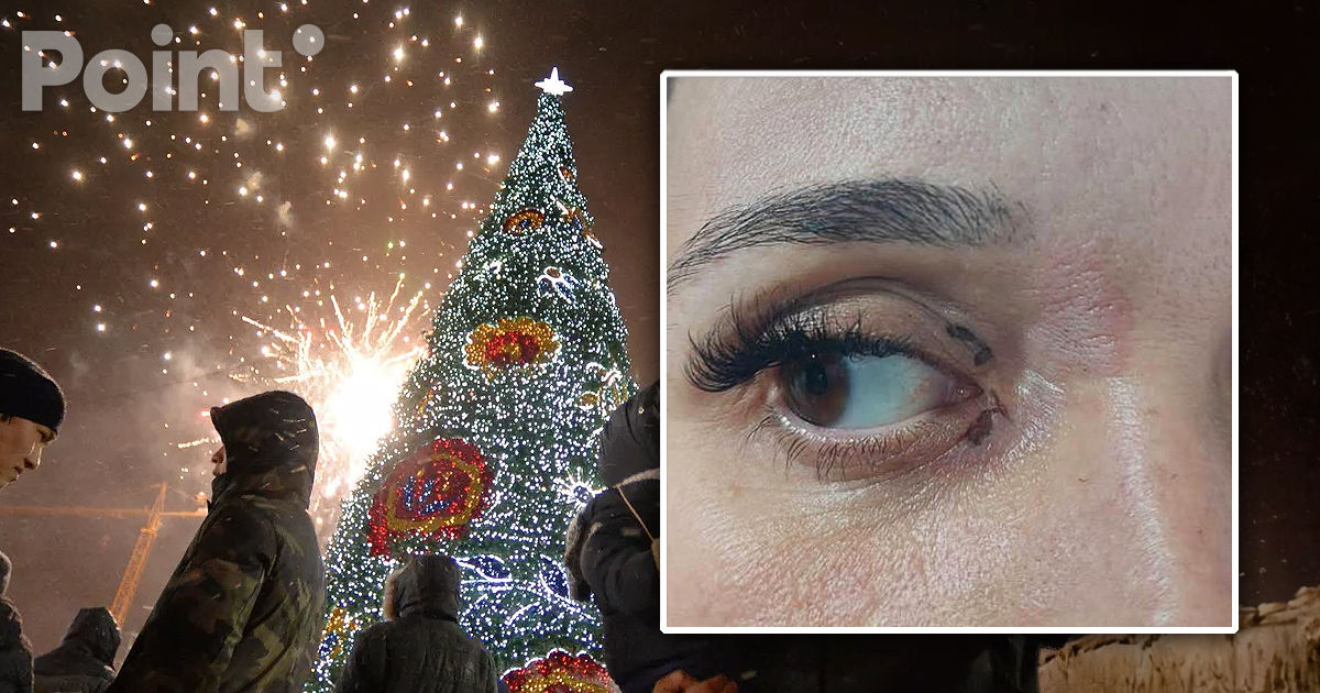 O explozie de artificii de Anul Nou a lovit o mulțime de oameni la Ceadâr-Lunga.