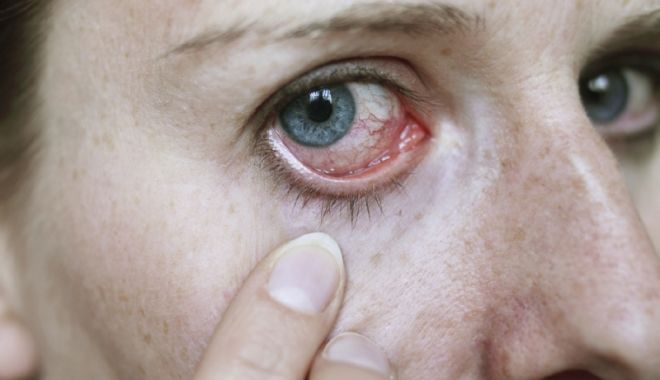 Date alarmante: Tot mai mulţi moldoveni suferă de afecțiuni oftalmologice Foto: Cuget Liber