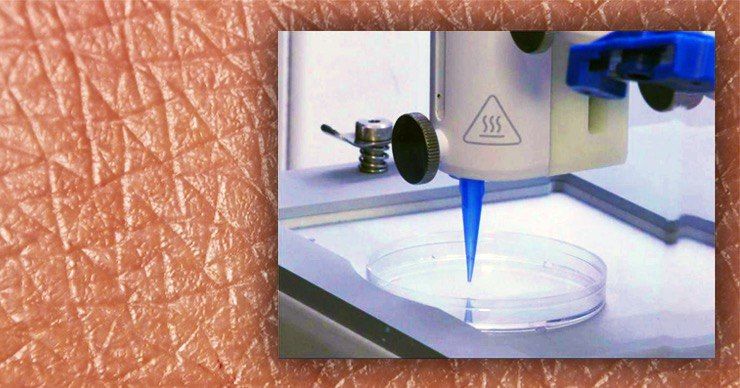 Американские ученые впервые создали на 3D-принтере образец кожи с кровеносными сосудами. Фото: Point.md.