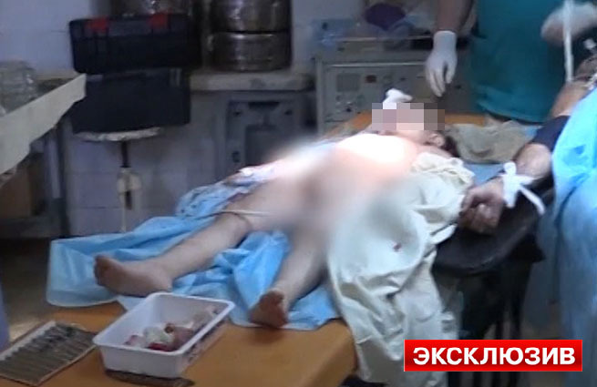 Хирурги насчитали как минимум 30 осколков размером от одного до пяти миллиметров, попавших ребенку в голову.