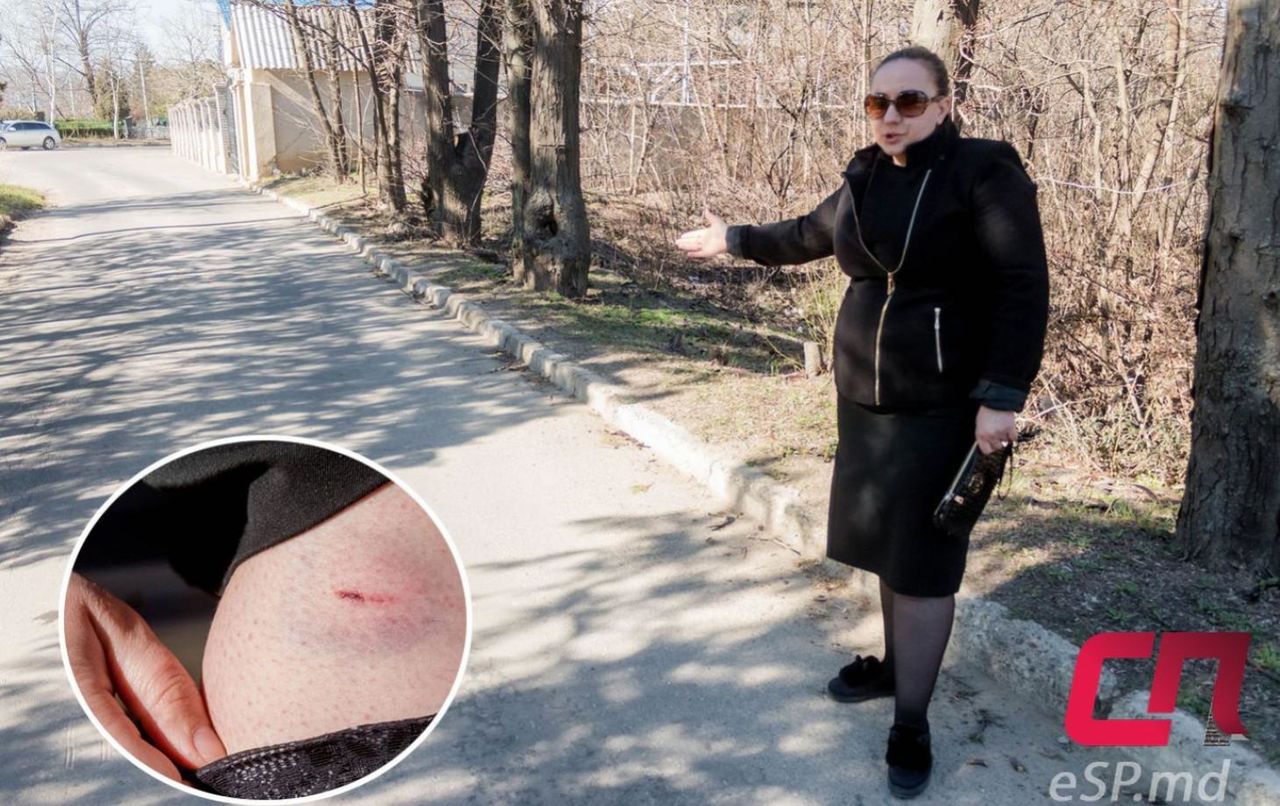 По словам Дарьи, она не сразу обнаружила, что пёс прокусил кожу.