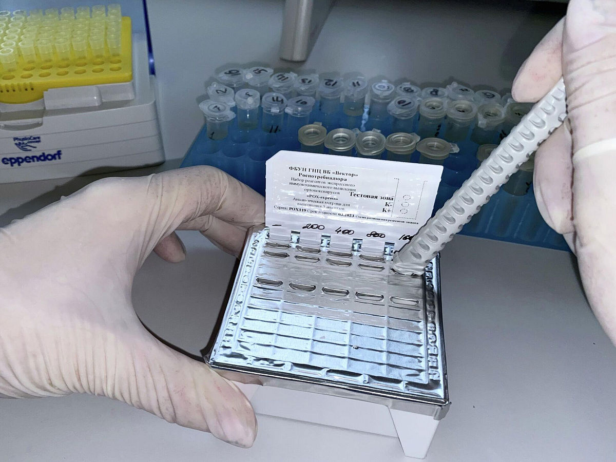 OMS aprobă utilizarea primului test pentru depistarea variolei maimuțelor.