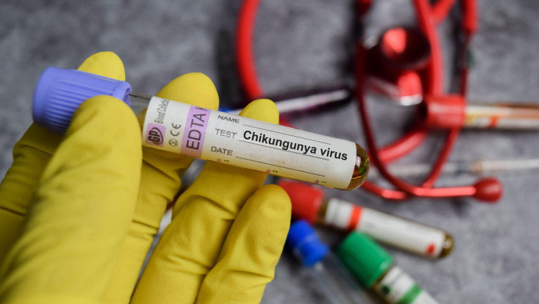 Primul caz de infectare cu virusul Chikungunya, confirmat în România.