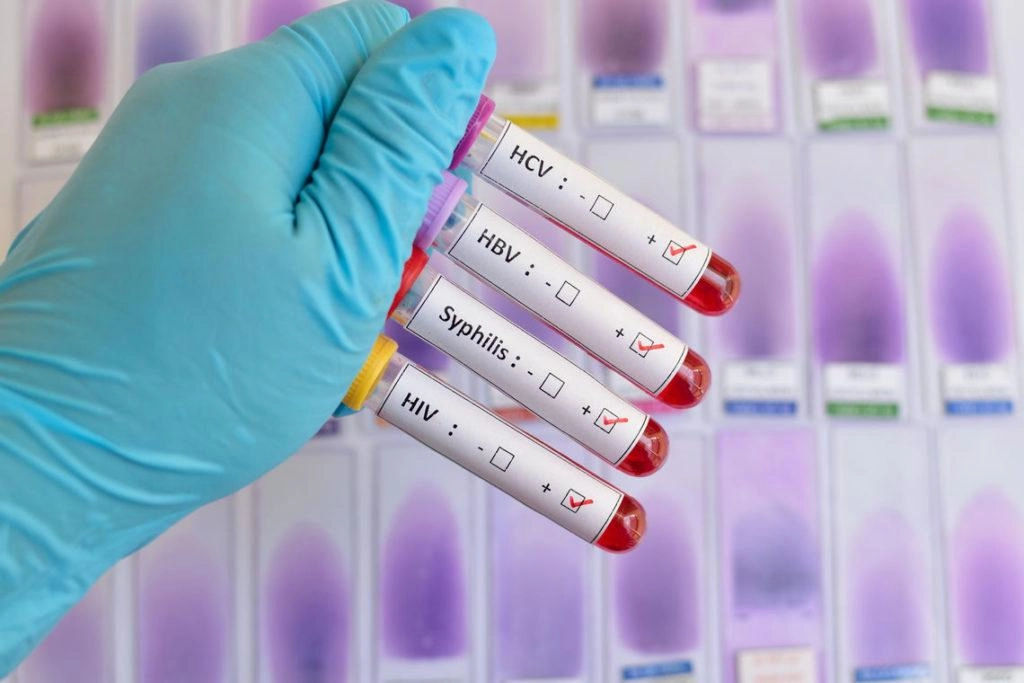 Europa înregistrează o creștere record a infecțiilor bacteriene cu transmitere sexuală în ultimii 10 ani.