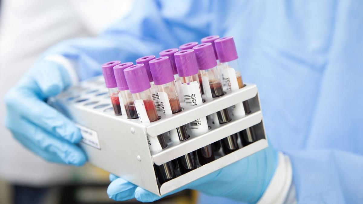 Studiu: Grupa sanguină influențează probabilitatea unui accident vascular cerebral prematur.
