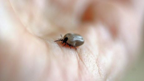 Как правило, укусы клещей не болезненны, но очень опасны.