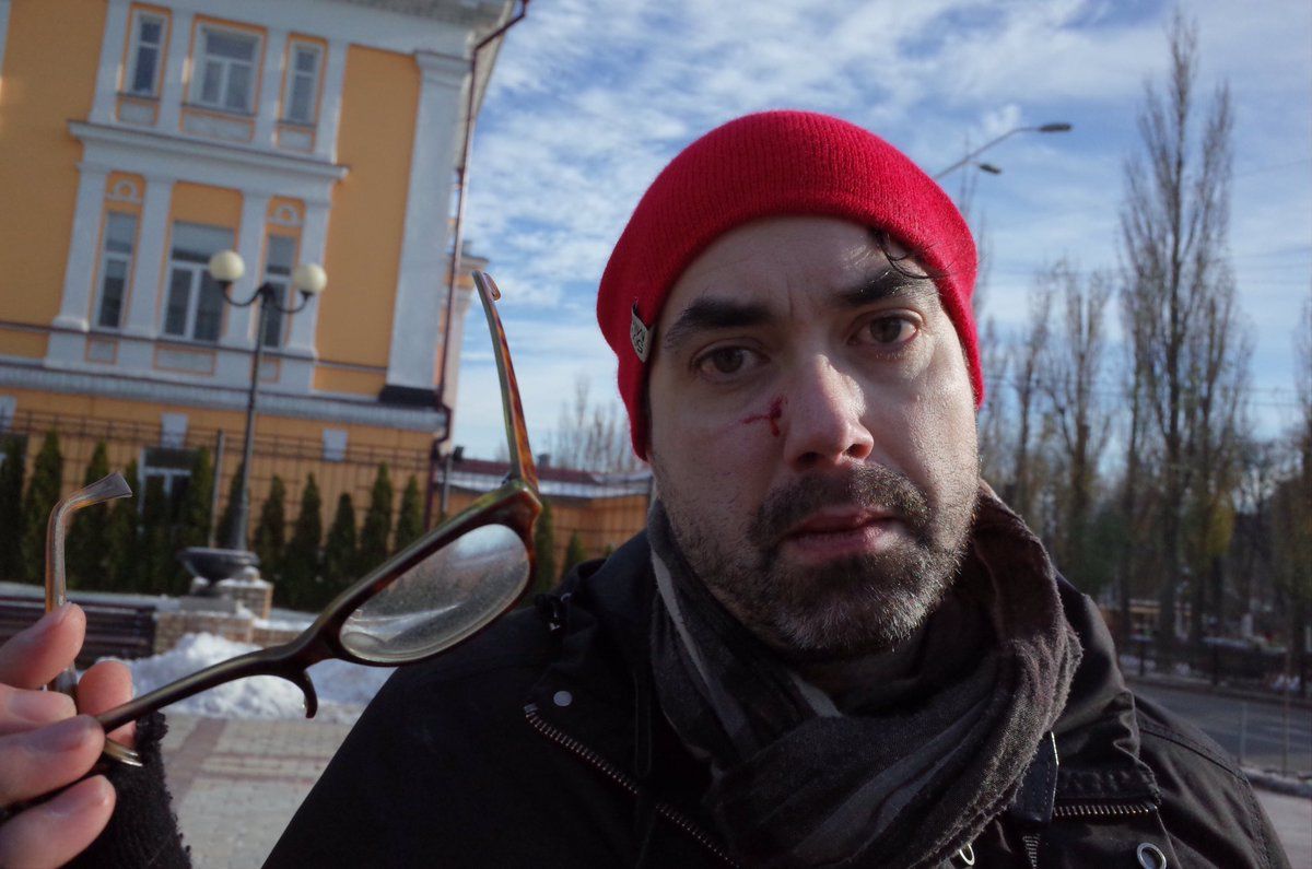 Оттава возмущена нападением на канадского журналиста в Киеве.