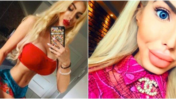 O tânără și-a distrus corpul ca să arate ca păpuşa Barbie
